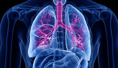 什么是慢性阻塞性肺病 (Chronic Obstructive Pulmonary Disease)，為何與新冠疫情有關(guān)？